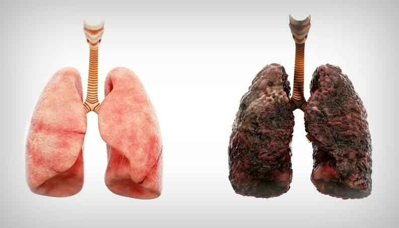 Image Title My Image